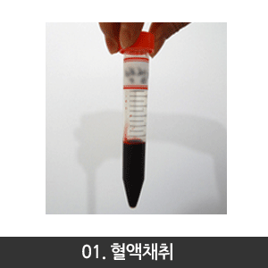 자가혈청만드는과정-1혈액채취