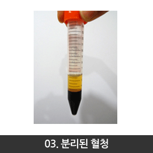 자가혈청만드는과정-3분리된혈청